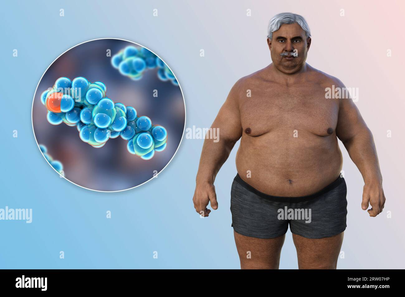 Homme en surpoids et molécule de cholestérol, illustration Banque D'Images