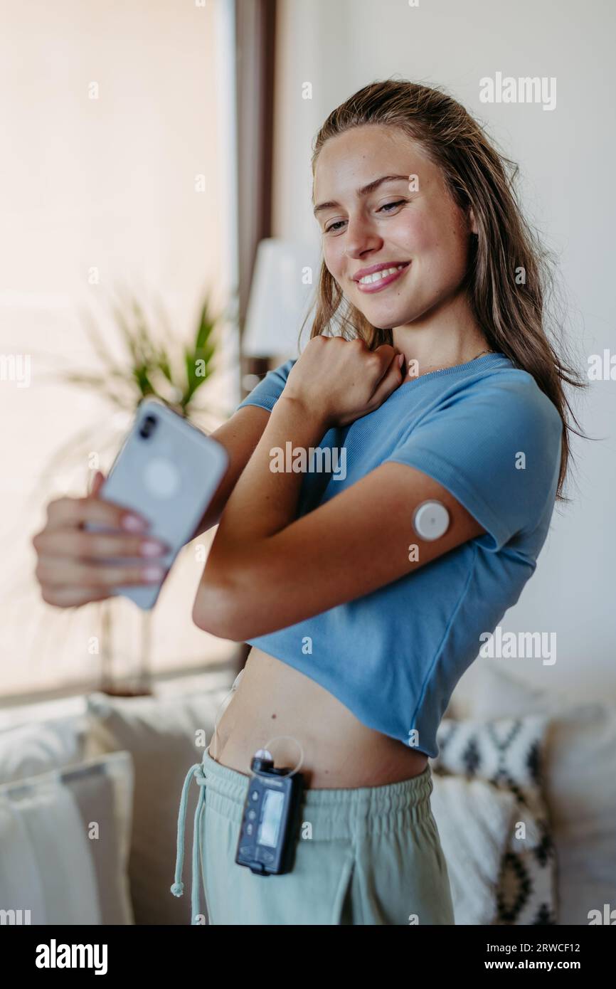 Belle fille diabétique prenant un selfie, ayant une pompe à insuline et un moniteur de glucose continu sur son bras. Banque D'Images