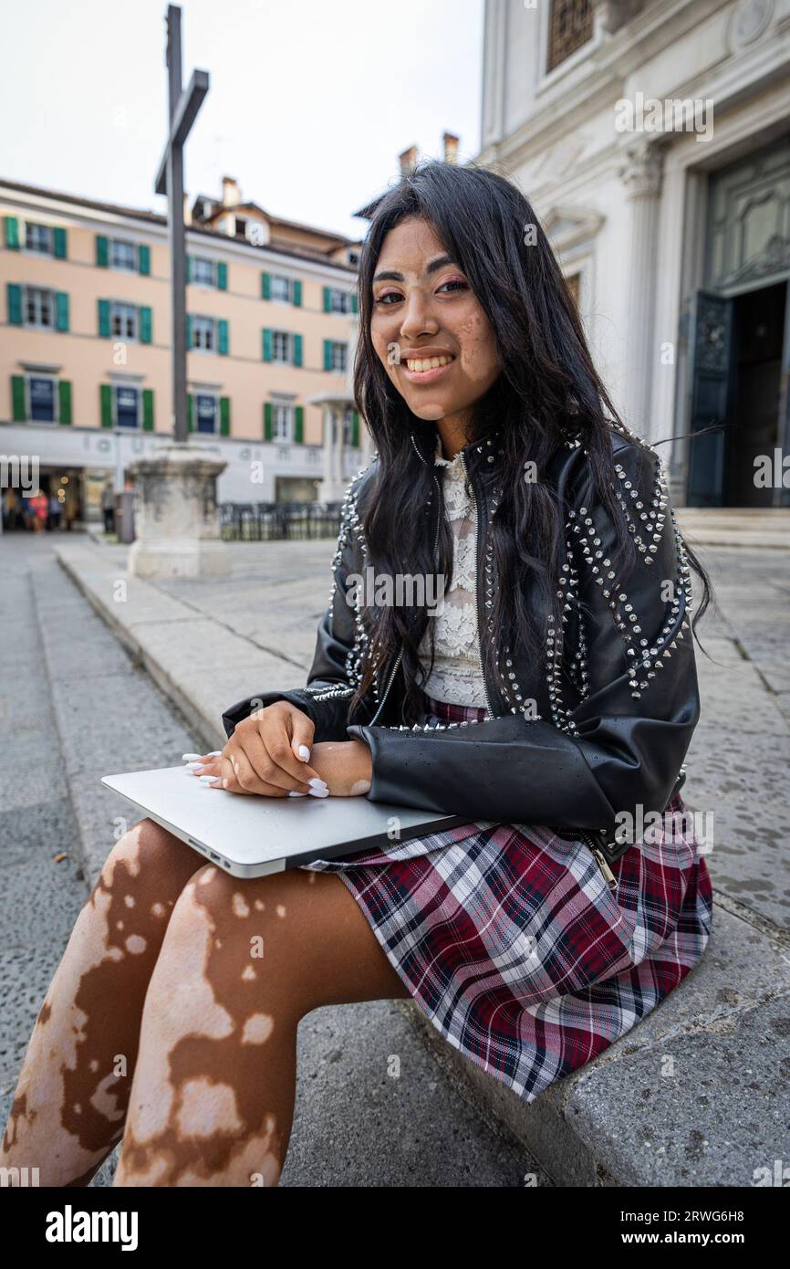 Une jeune étudiante souriante avec vitiligo assise avec son ordinateur portable. Fille hispanique Banque D'Images