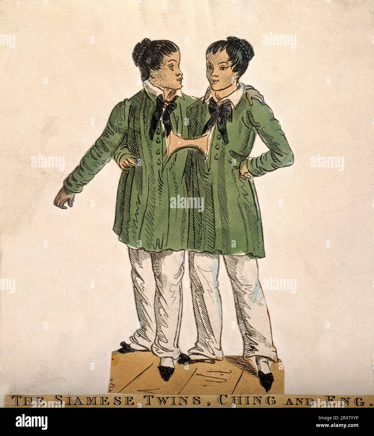 Chang et Eng les jumeaux siamois, 1811 – 1874, gravure colorée Banque D'Images