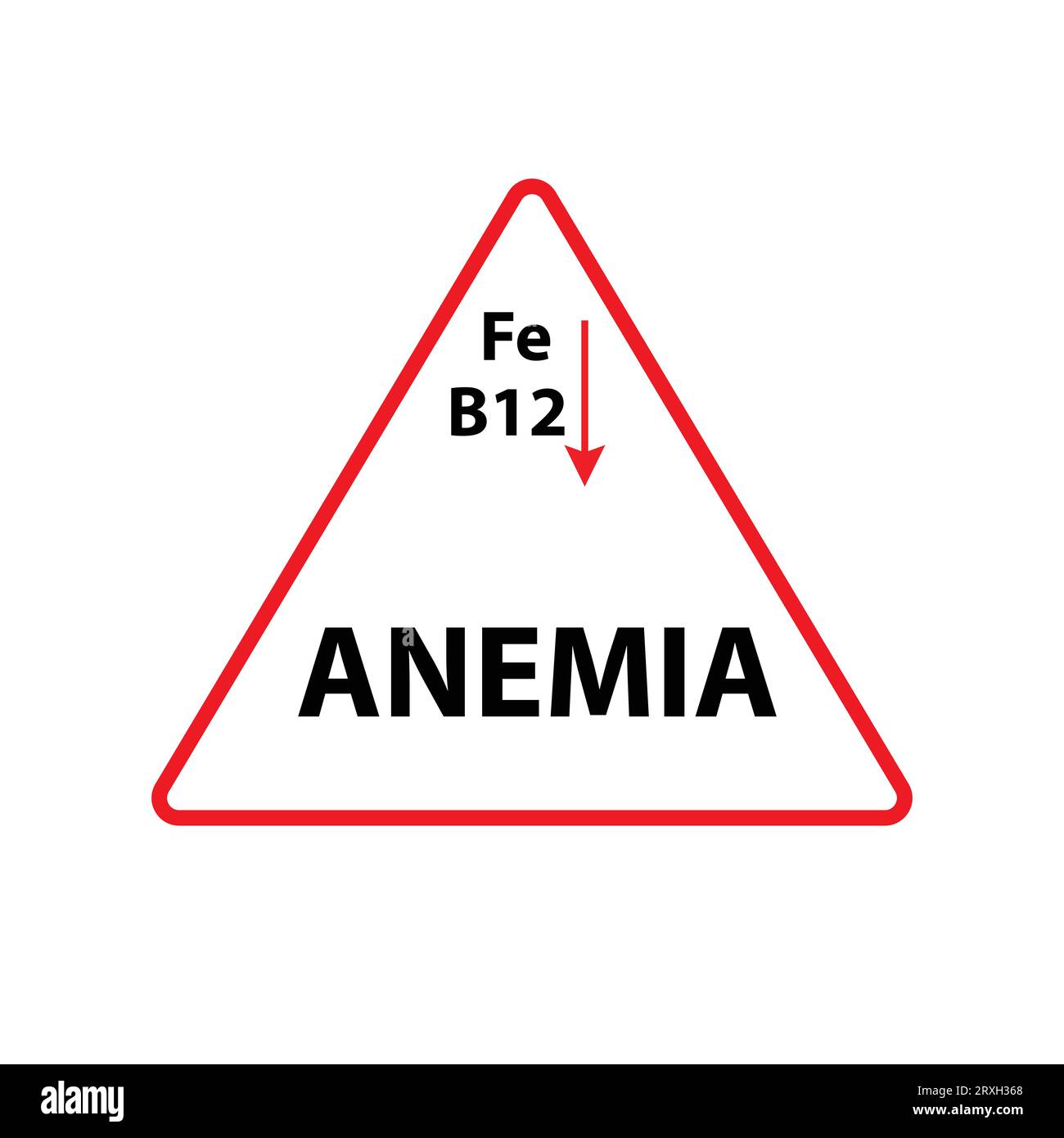 Triangle rouge avec texte anémie et symbole atomique de fer et B12 avec une flèche rouge vers le bas Illustration de Vecteur