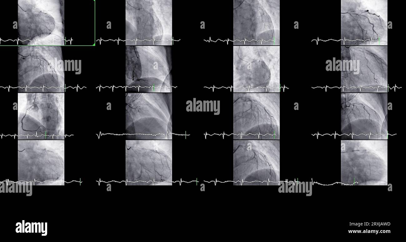 Problem Causer Le cathétérisme cardiaque peut aider le médecin à diagnostiquer et à ...