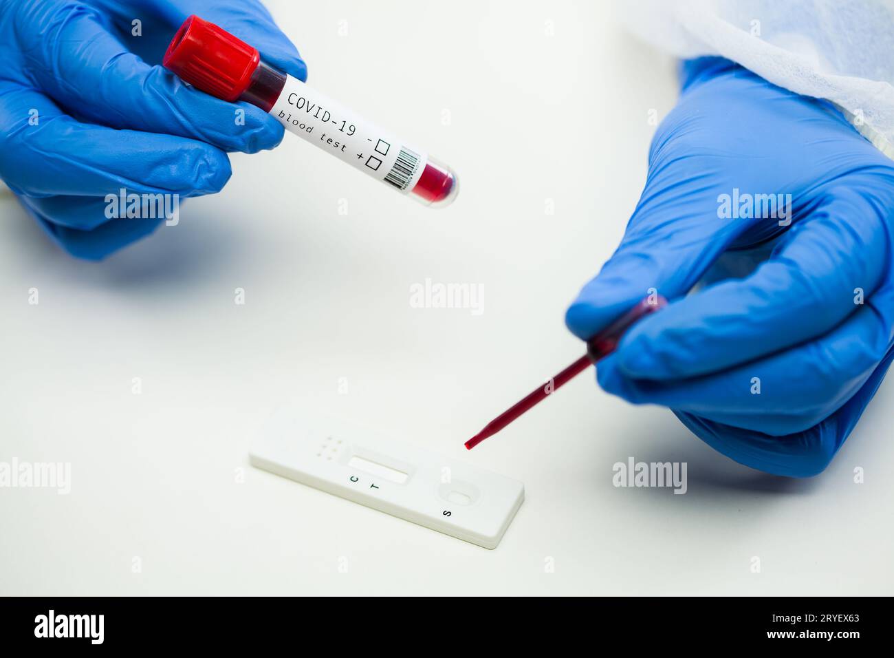 Scientifique technique de laboratoire britannique plaçant un échantillon de sang sur une cassette RDT de test de diagnostic rapide Banque D'Images