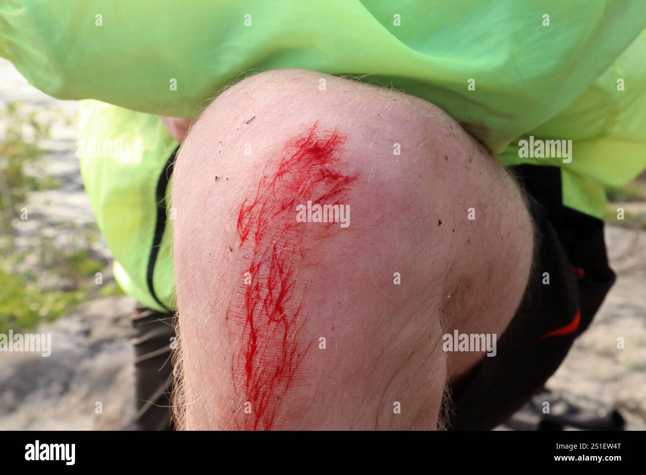 Genou saigné. Petite blessure versant du sang. Gros plan et isolé. Banque D'Images