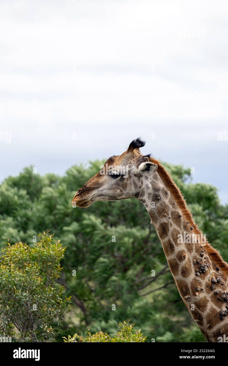 Girafe malade avec des excroissances sur la vue latérale du cou. Animal dans la nature sauvage. Afrique du Sud, parc national Kruger, savane Banque D'Images