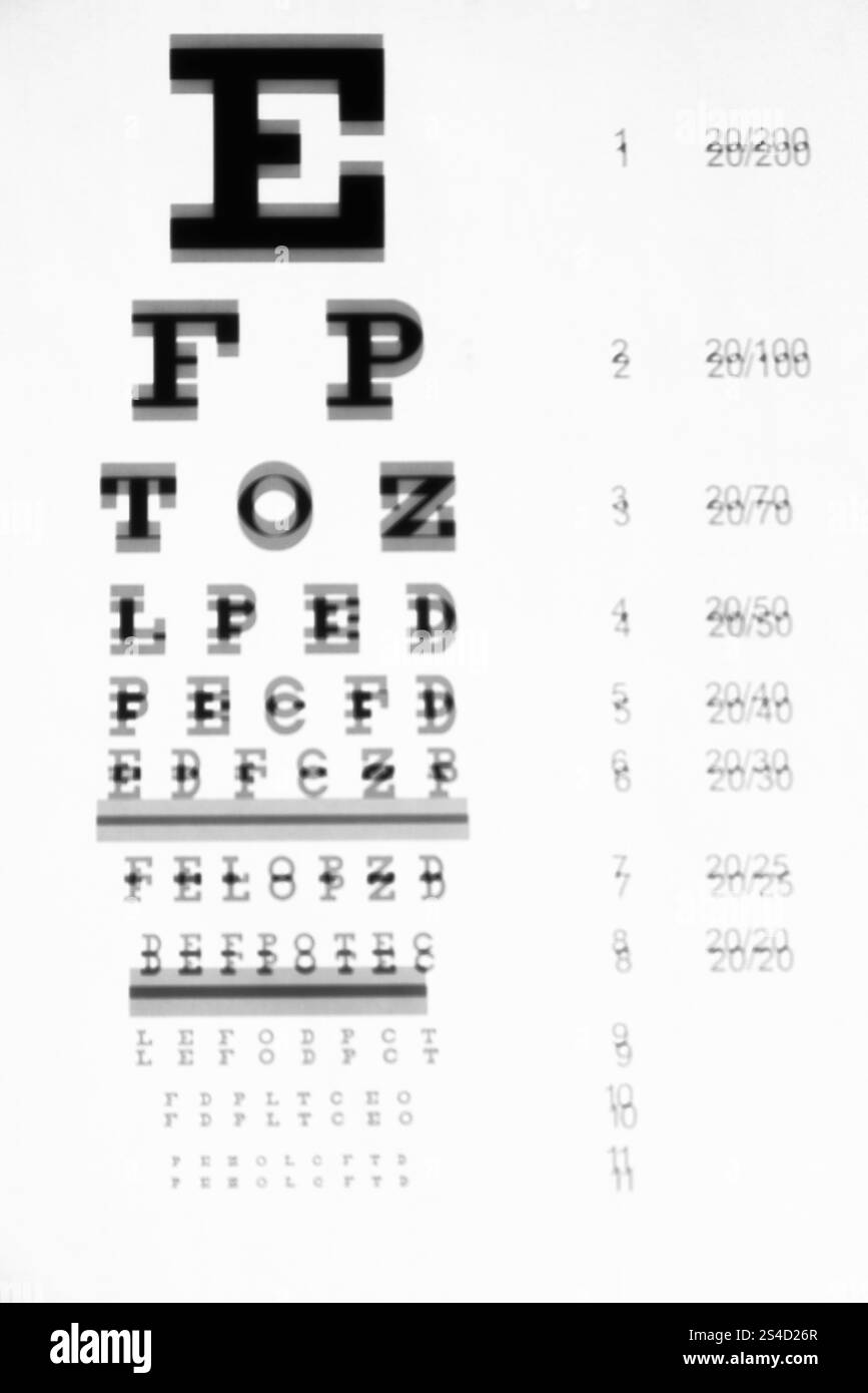 Exemple de vision avec astigmatisme, une erreur de réfraction qui provoque une vision déformée ou floue ou une double focalisation à n'importe quelle distance. Banque D'Images