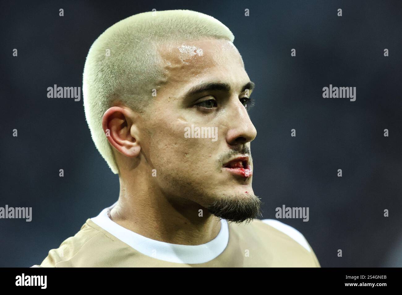 Danny Imray de Bromley avec une lèvre coupée lors du match de 3ème tour de la FA Cup Emirates Newcastle United vs Bromley FC au James's Park, Newcastle, Royaume-Uni, 12 janvier 2025 (photo par Alfie Cosgrove/News images) Banque D'Images