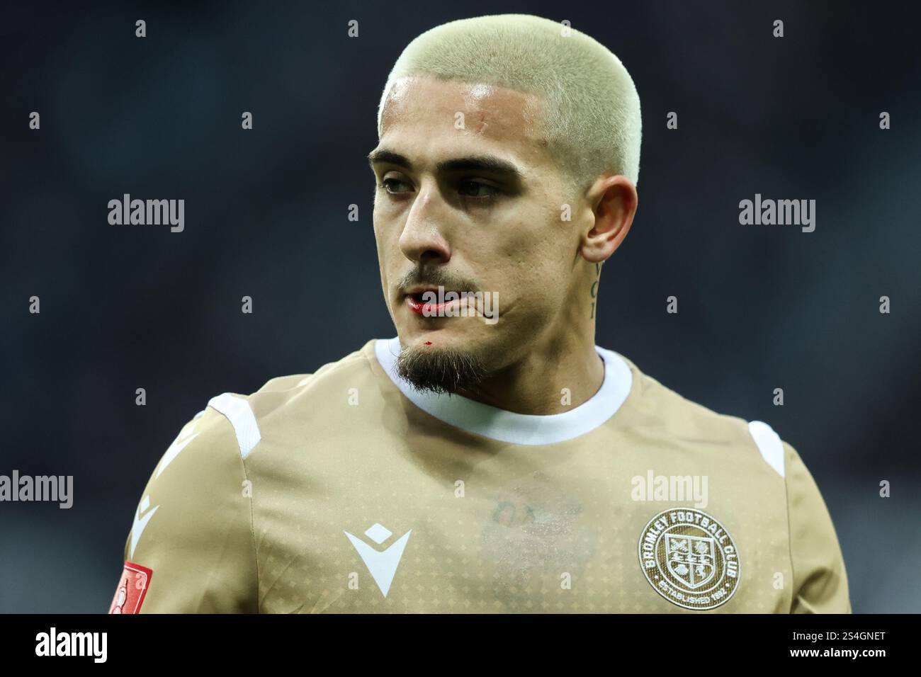 Danny Imray de Bromley avec une lèvre coupée lors du match de 3ème tour de la FA Cup Emirates Newcastle United vs Bromley FC au James's Park, Newcastle, Royaume-Uni, 12 janvier 2025 (photo par Alfie Cosgrove/News images) Banque D'Images