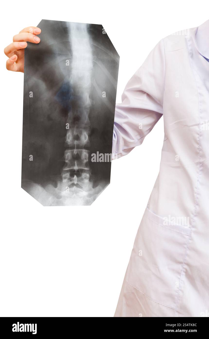 Montre infirmière radiographie avec colonne vertébrale humaine isolé sur fond blanc Banque D'Images