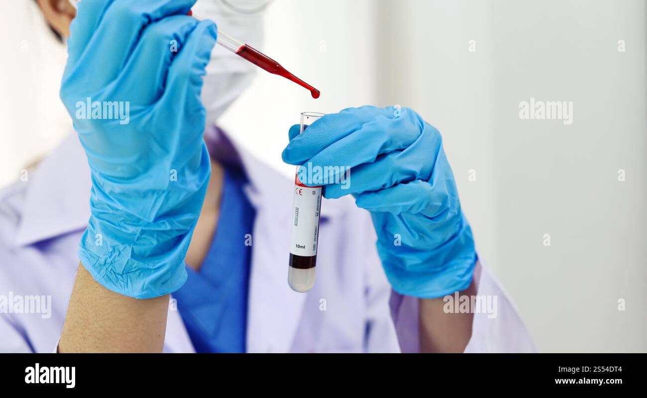 Scientifique tenant un tube de prélèvement sanguin infecté par le coronavirus covid-19. Analyse ADN du sang en laboratoire avec des tubes de prélèvement de sang et Banque D'Images