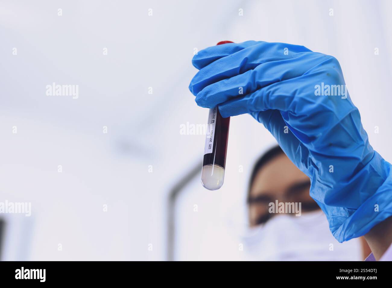 Scientifique tenant un tube de prélèvement sanguin infecté par le coronavirus covid-19. Analyse ADN du sang en laboratoire avec des tubes de prélèvement de sang et Banque D'Images