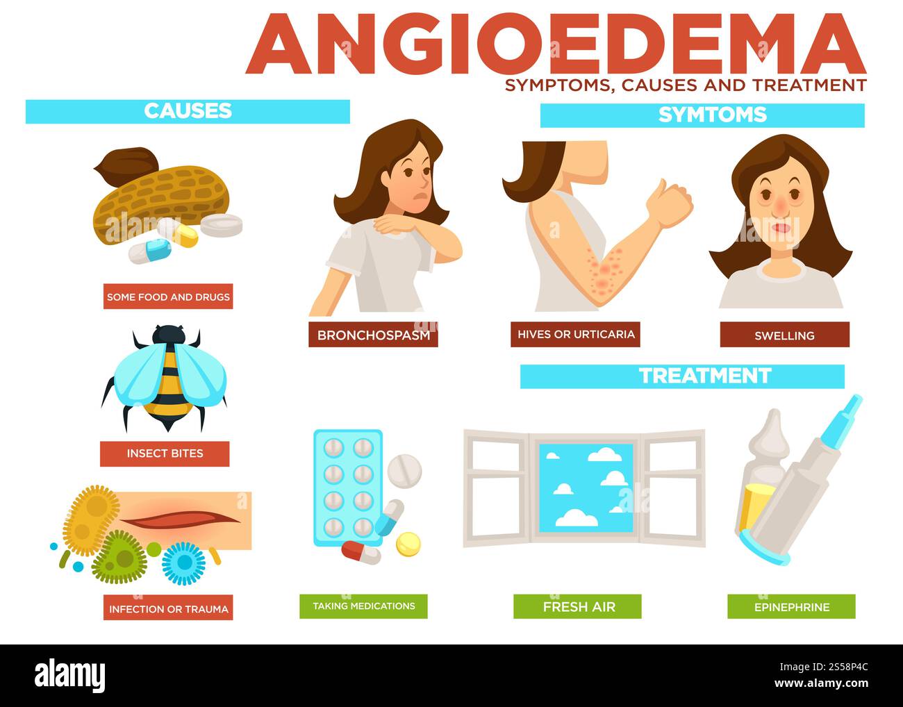 Symptôme d'angioedème, causes et traitement du vecteur de la maladie. Affiche avec raison de la maladie nourriture et médicaments, piqûres d'insectes, infection et traumatisme. Prenez des médicaments et prenez de l'air frais, de l'épinéphrine. Symptôme d'angioedème, causes et traitement du vecteur de la maladie Illustration de Vecteur