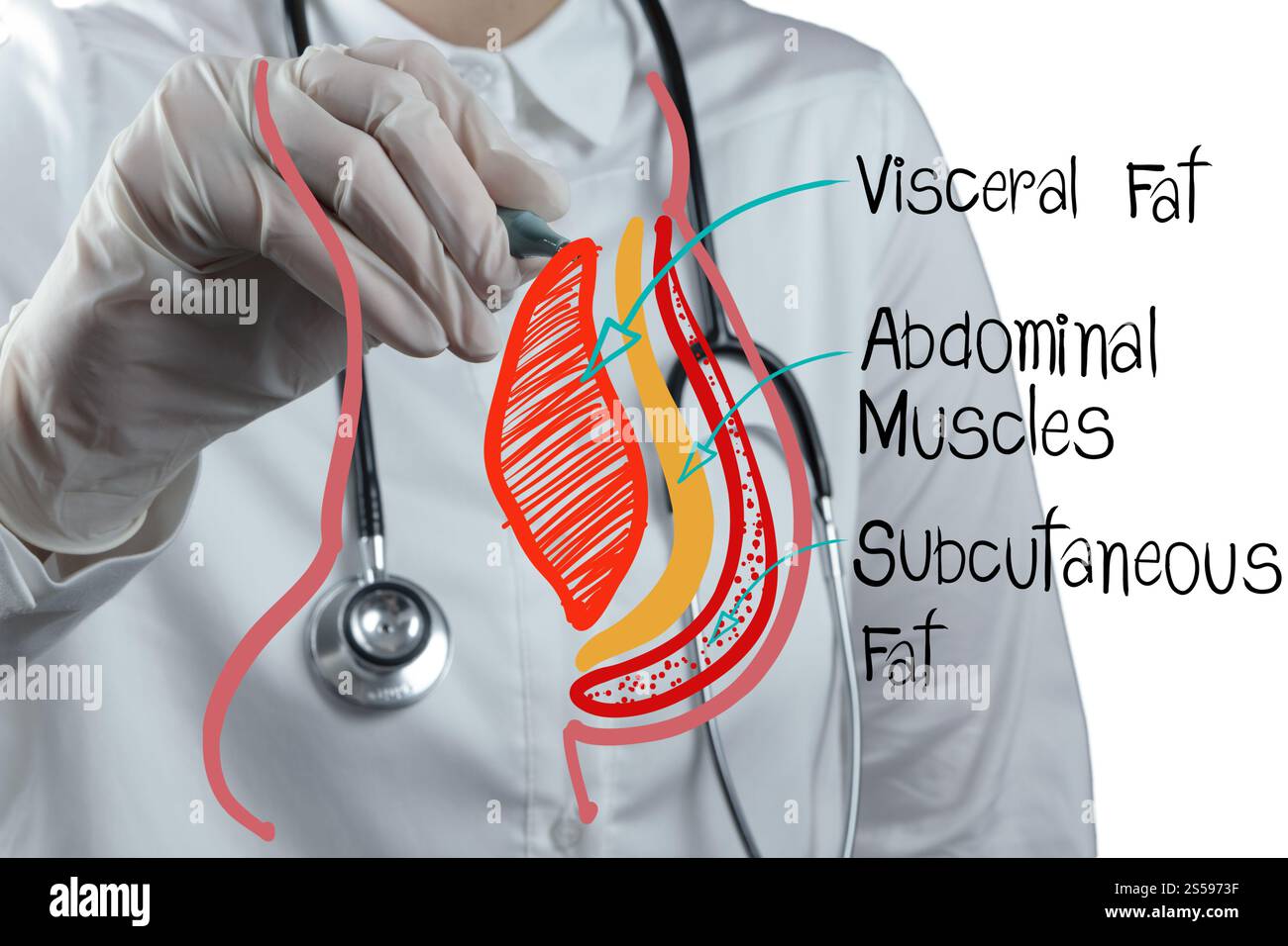 le médecin dessine la graisse abdominale comme concept médical Banque D'Images
