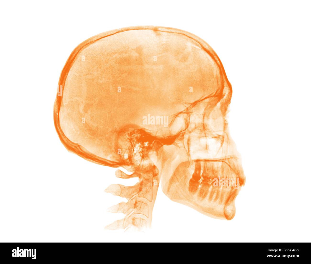 Crâne humain. Image radiographique orange isolée sur fond blanc. Crâne humain. Image radiographique orange sur fond blanc Banque D'Images
