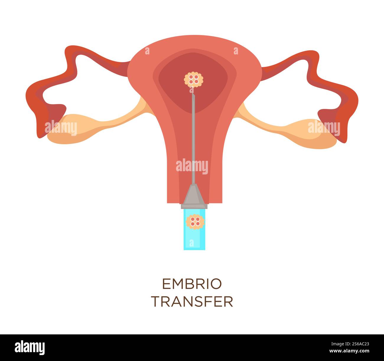 Transfert Embryon Utérus et ovule transfert embryon insémination artificielle organe ...