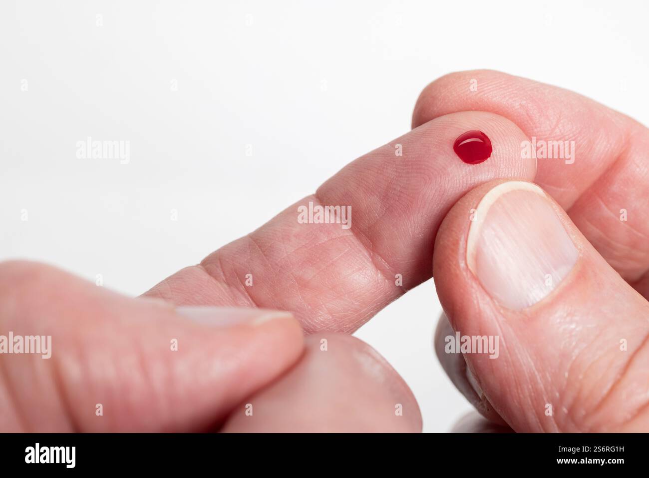 Goutte de sang du bout des doigts, petit échantillon de sang, sang capillaire, fond blanc, Banque D'Images