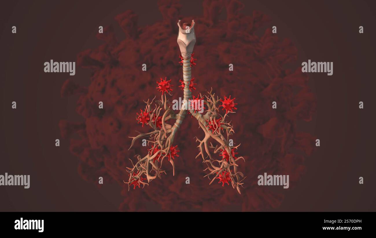 L'impact du VPH sur la santé respiratoire Banque D'Images