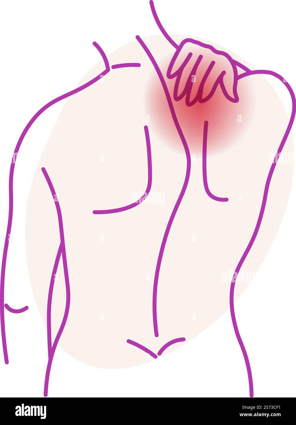 Arthrose ou mal de cou, personnage isolé d'homme montrant la localisation de l'inflammation. Symptômes de sténose spinale ou hernie discale. Dessin minimaliste avec zone de douleur, vecteur dans un style plat. Mal de cou, douleur dans la partie supérieure du problème de santé du dos Illustration de Vecteur