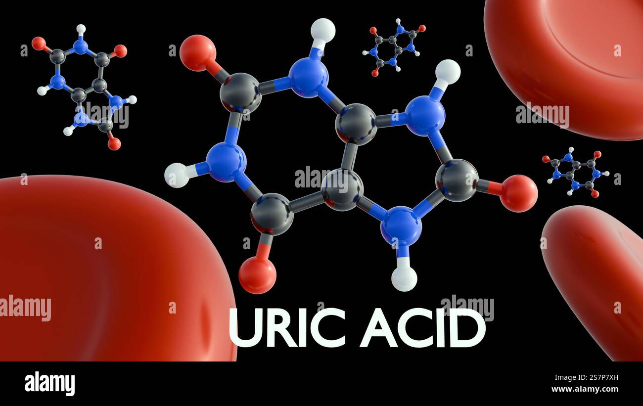 Rendu 3D des molécules d'acide urique et des globules rouges. L'hyperuricémie survient lorsqu'il y a trop d'acide urique dans le sang. Banque D'Images