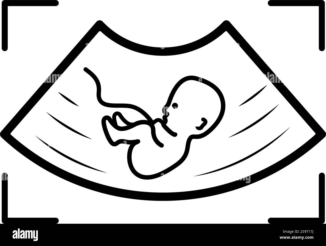 Illustration du symbole de l'icône de grossesse échographique Illustration de Vecteur