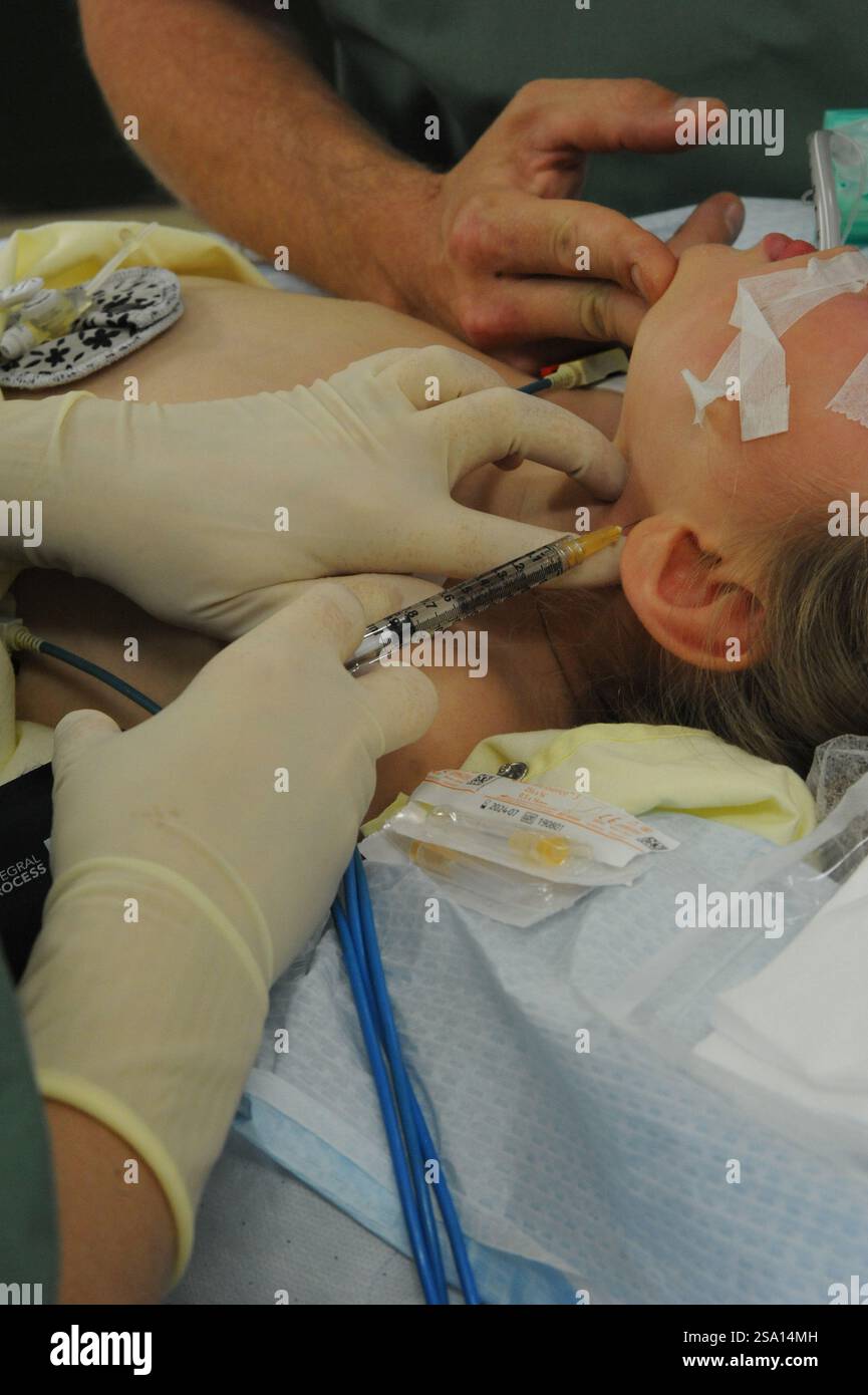 Les injections de toxine botulique sont utilisées dans le traitement de la contraction musculaire involontaire. Banque D'Images