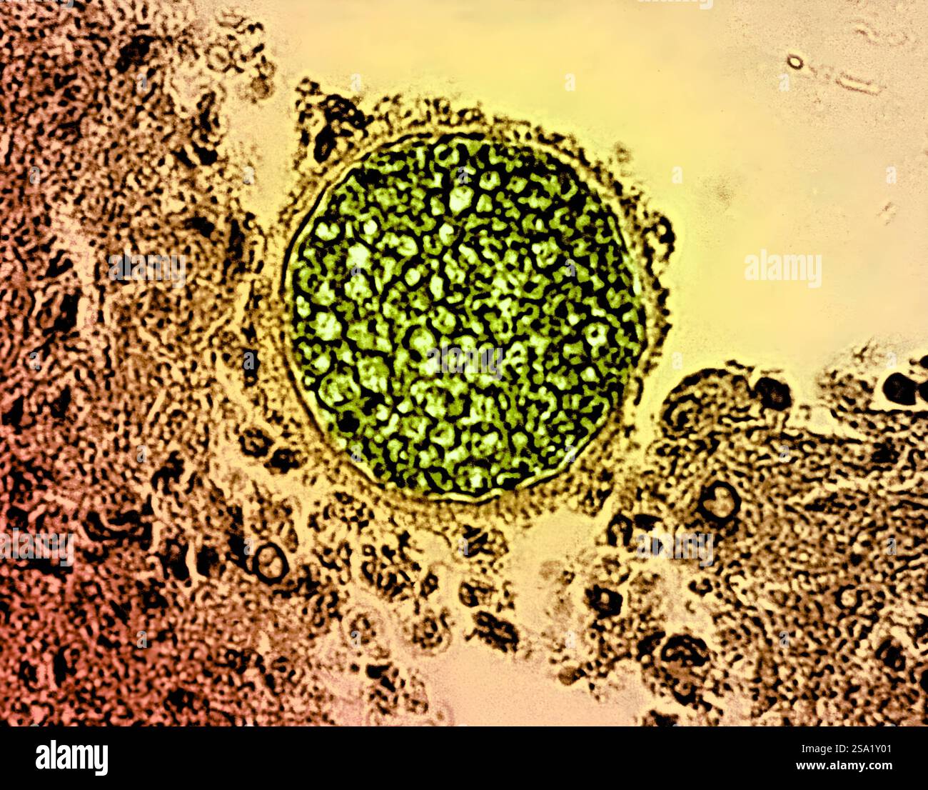 Sphérule fongique Coccidioides verte trouvée dans un échantillon de tissu. Cet organisme provoque la coccidioïdomycose, également connue sous le nom de fièvre de la vallée. Crédit : micrographie par colorisation CDC et effets visuels par NIAID. Fièvre de la vallée/sphérule fongique Coccidioïdes 016931_039 Banque D'Images