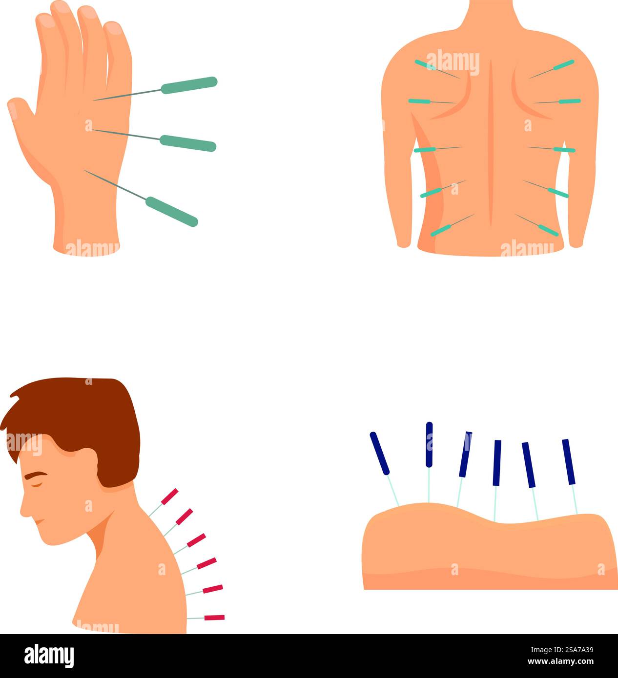 Ensemble d'illustration de la thérapie d'acupuncture, un holistique. Naturel. Et ancienne technique de médecine chinoise pour soulager la douleur. Relaxation. Et rajeunissement. Utilisation non invasive. Thérapeutique. Collection de quatre illustrations montrant des points d'acupuncture sur le corps humain Illustration de Vecteur