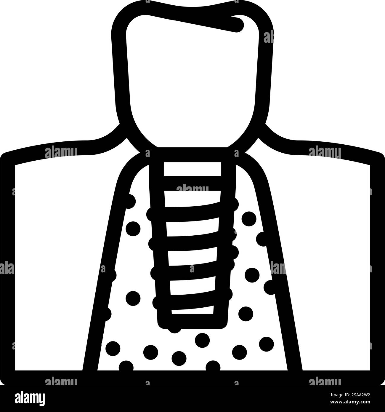 vecteur d'icône de ligne de chirurgie d'implant dentaire. signe de chirurgie implantaire dentaire. illustration noire du symbole de contour isolé. illustration vectorielle d'icône de ligne de chirurgie d'implant dentaire Illustration de Vecteur vecteur d'icône de ligne de chirurgie d'implant dentaire. signe de chirurgie implantaire dentaire. illustration noire du symbole de contour isolé. illustration vectorielle d'icône de ligne de chirurgie d'implant dentaire Illustration de Vecteur