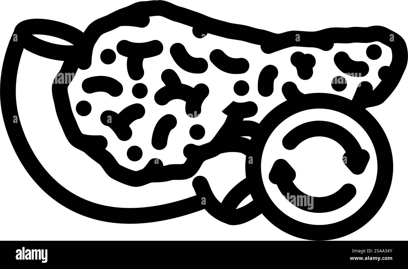 vecteur d'icône de ligne de chirurgie de greffe de pancréas. signe de la chirurgie de transplantation pancréatique. illustration noire du symbole de contour isolé. illustration vectorielle d'icône de ligne de chirurgie de greffe de pancréas Illustration de Vecteur