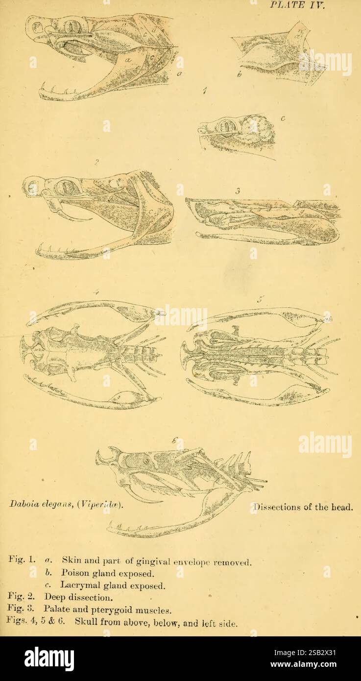 Serpents indiens, Madras, Higginbotham, 1874, Chine, Inde, serpents, Asie du Sud, Daboia russelii, taxonomie : sous-ordre = Serpentes, Journée mondiale du serpent, cette illustration présente des études anatomiques détaillées de la tête et des structures associées de l'espèce Dalogia degens, communément appelée Viperinae. Les figures étiquetées illustrent divers aspects de la dissection, mettant en évidence des parties anatomiques spécifiques. - **La figure 1** montre la peau et une section de l'enveloppe gingivale enlevée, donnant un aperçu des structures externes. - **La figure 2** illustre l'exposition de la glande empoisonnée, en insistant sur le o Banque D'Images