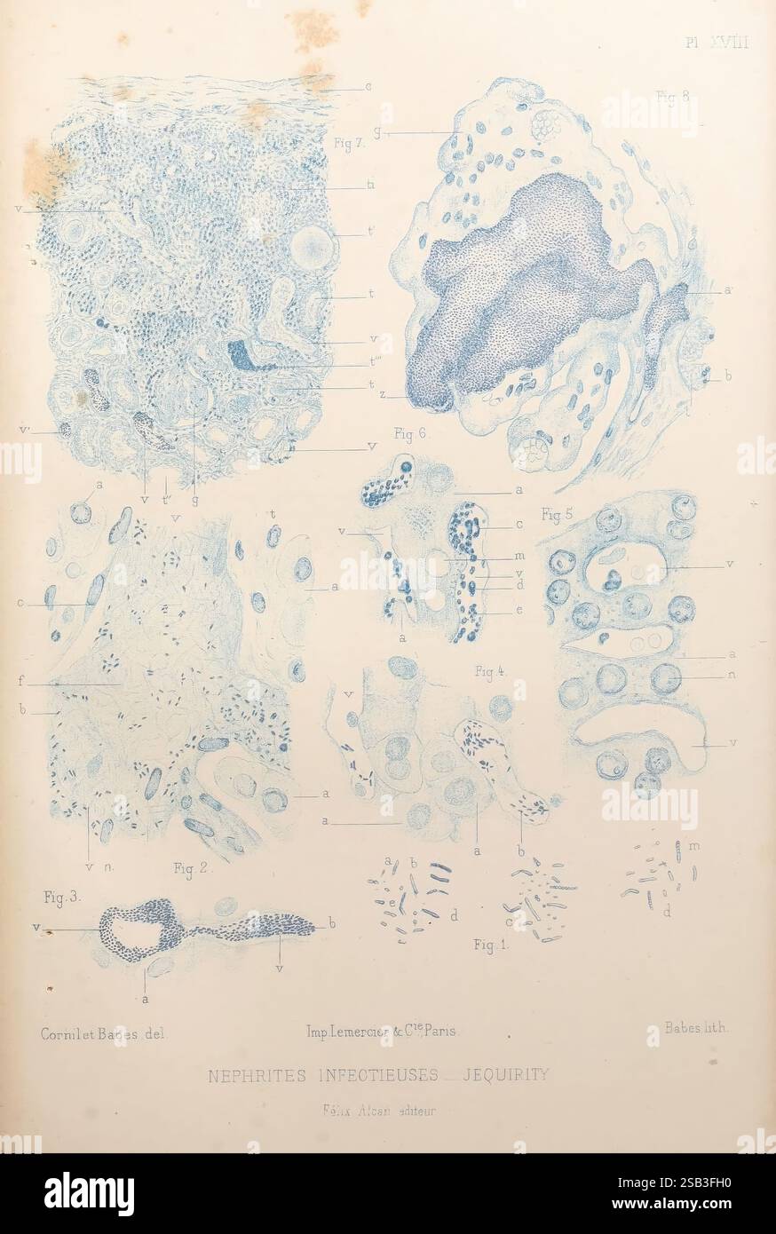 Les, bactéries, et, leur, rôle, dans, l'anatomie, et, l'histologie, pathologiques, des, maladies, infectieuses, Paris, F, Alcan, 1885, bactéries, bactériennes, infections, pathogénicité, pathologie, cette illustration présente une série de vues microscopiques détaillées illustrant diverses structures cellulaires liées à la néphrite infectieuse. Chaque section est méticuleusement étiquetée et classée numériquement, mettant en évidence différents types de cellules et d'arrangements tissulaires. Les images mettent en évidence des caractéristiques telles que les tubules rénaux, les glomérules et les infiltrats cellulaires caractéristiques de l'infection. La démarche artistique c Banque D'Images