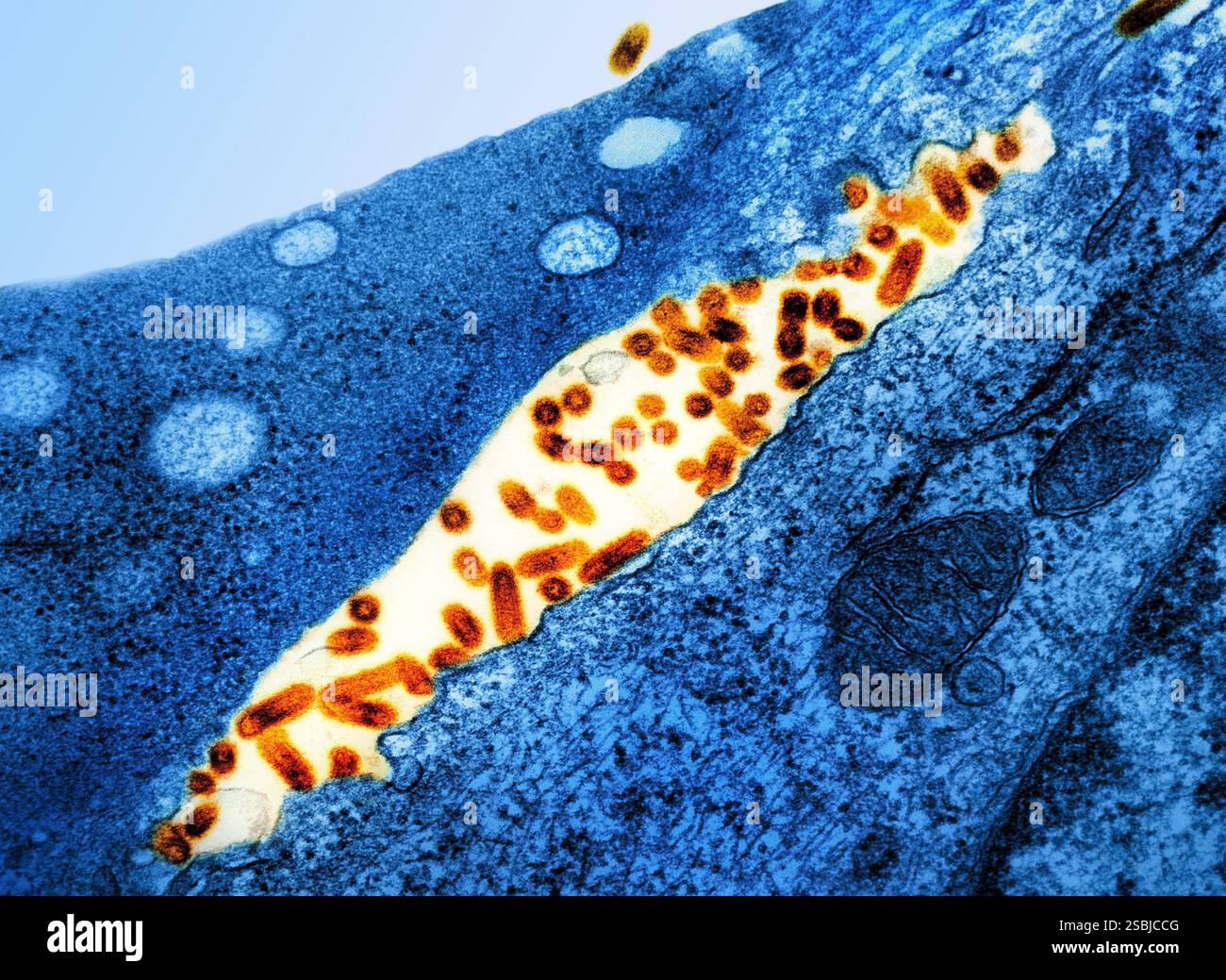 Micrographie électronique par transmission des particules du virus de la stomatite vésiculeuse (VSV) (orange) trouvées dans l'espace extracellulaire et bourgeonnement de la membrane plasmique des cellules infectées (bleu). Banque D'Images