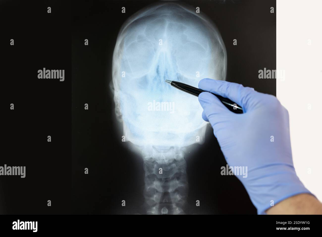 Gros plan d'un médecin pointant la radiographie du nez au cabinet d'un hôpital. Banque D'Images