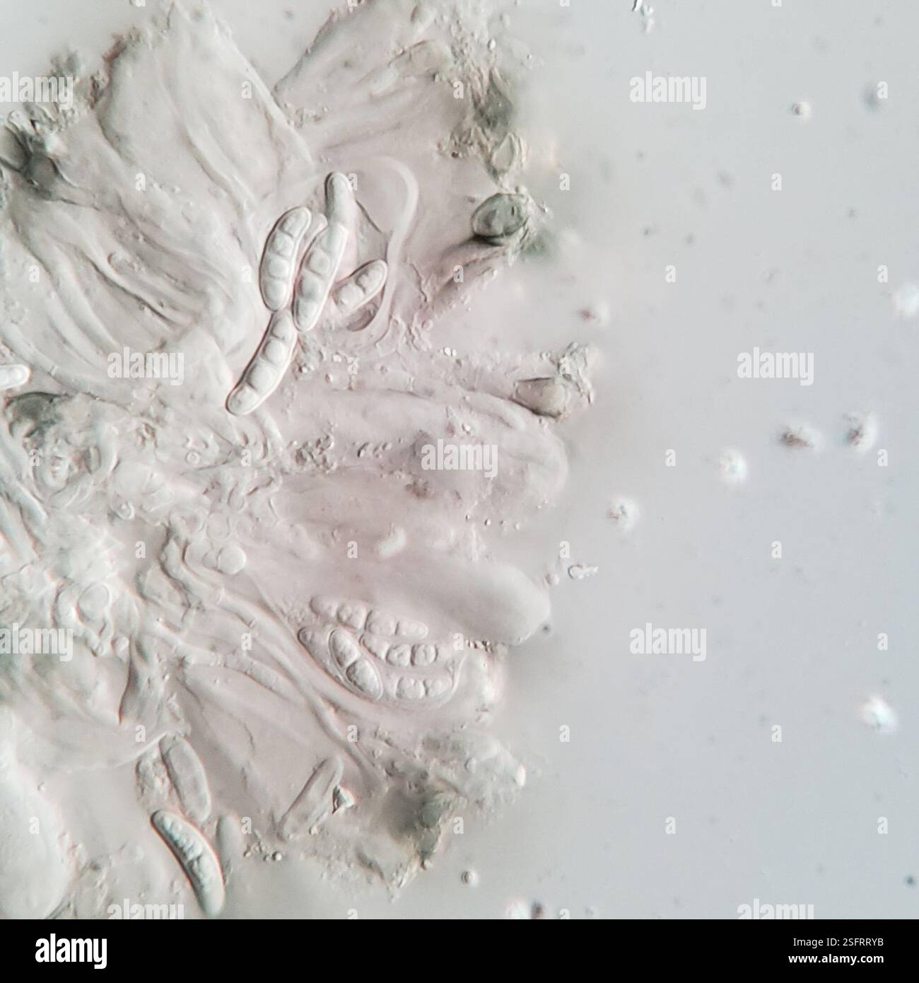 Lichen à point d'ombre (Micarea peliocarpa), champignons, aire de conservation de Starkey Hill, Arkell Road, Puslinch, ON, Canada, sur l'écorce décidue. Apothécie biatorine sur thalle gris-vert. Tholi Ki+ bleu foncé. Spores 8 par asque, 3-septées, (14-)15,8-19,4(-20) X (3,4-)3,9-5(-5,6) µm, longueur/largeur 3,9+/-0,65. Banque D'Images