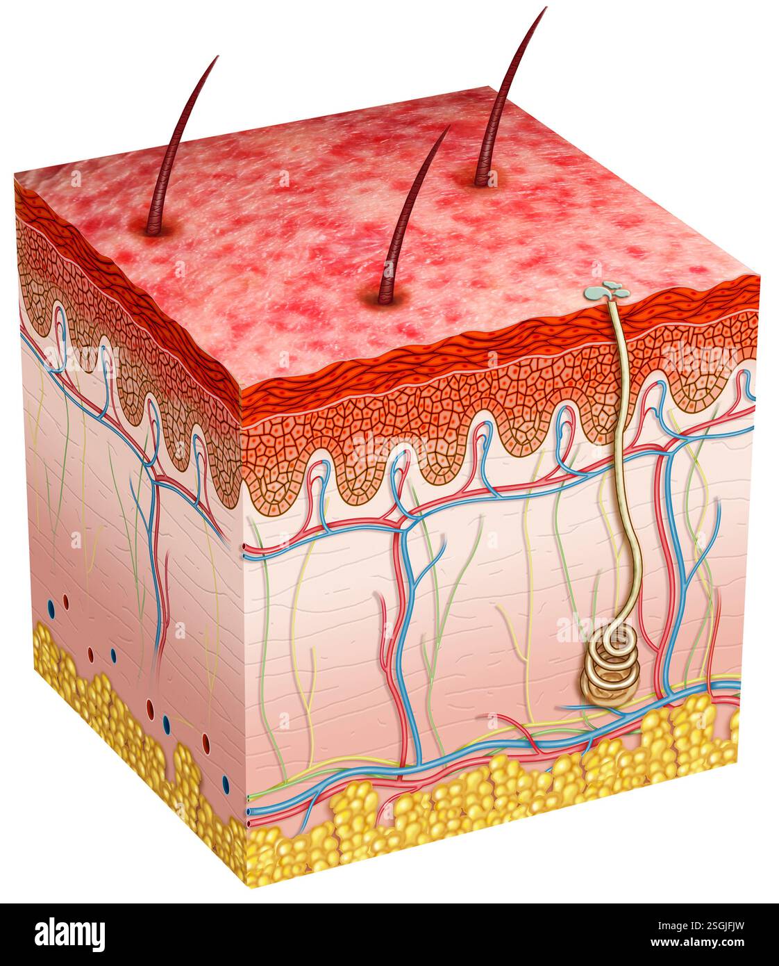 Schéma de peau atteinte de candidose. Infection causée par le champignon Candida, affectant la peau, la bouche, les organes génitaux et d'autres organes. Banque D'Images