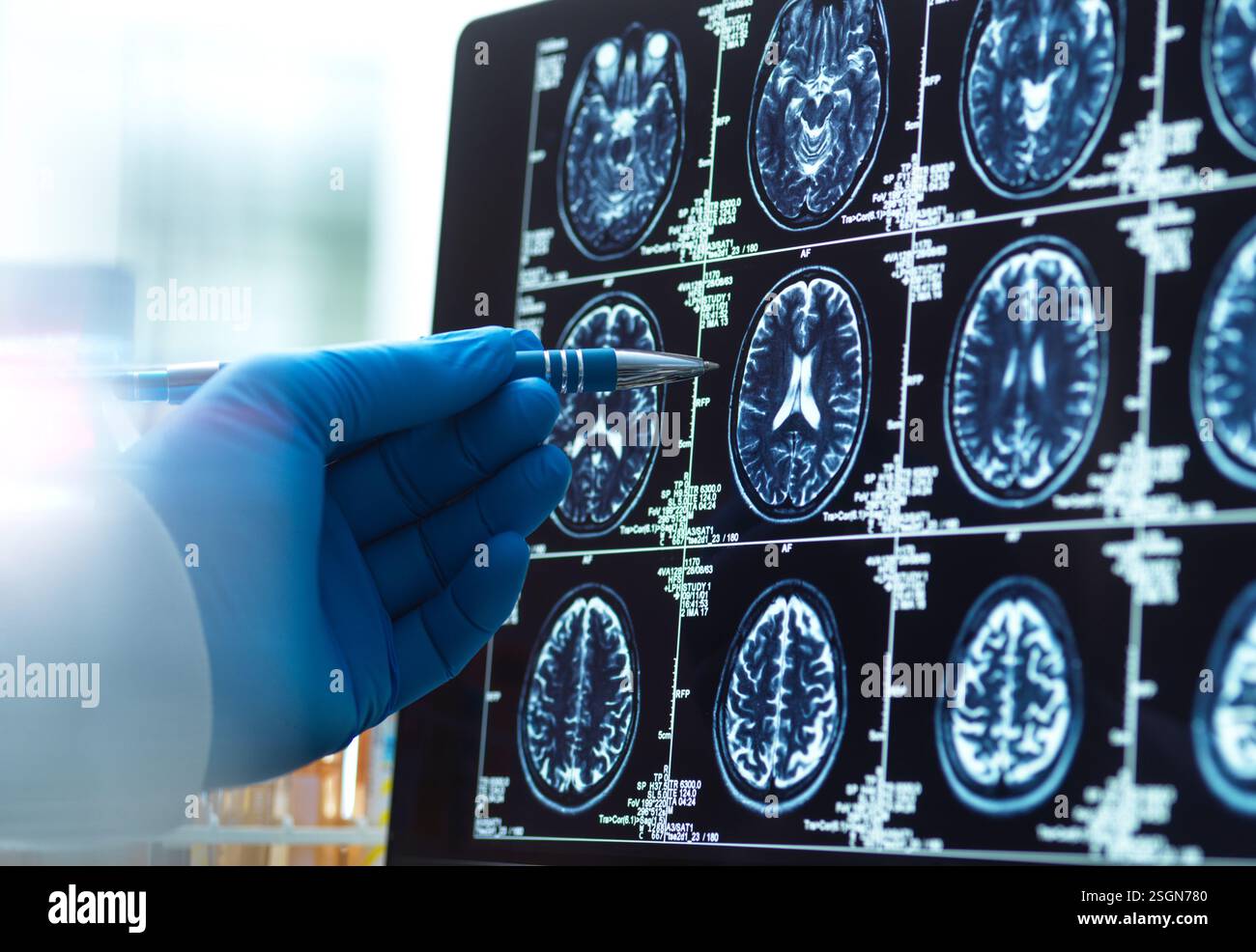 Médecin regardant un scan du cerveau pour un vieillissement et une maladie possibles Banque D'Images