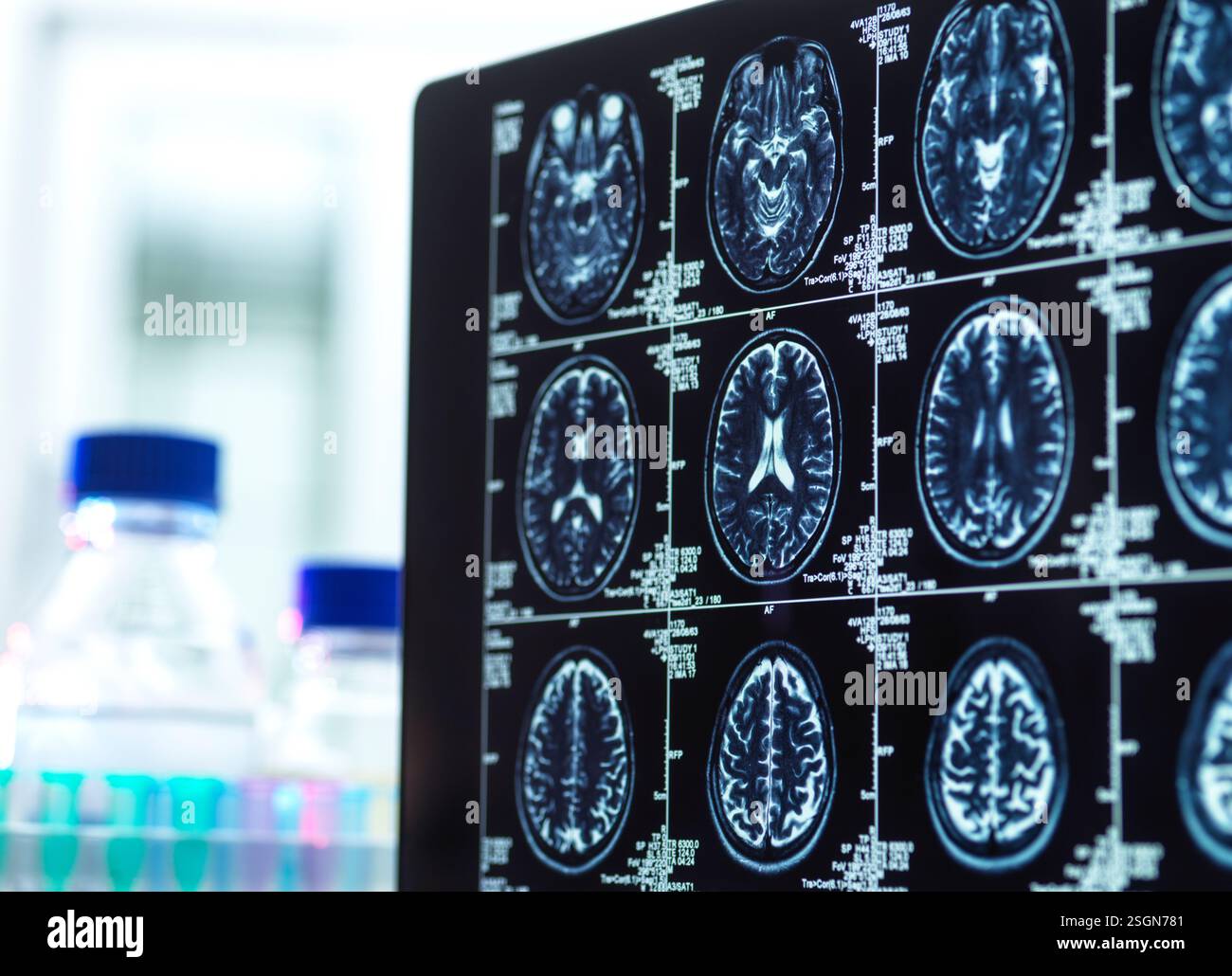 IRM d'un patient en attente d'analyse par un médecin pour vieillissement ou lésion Banque D'Images