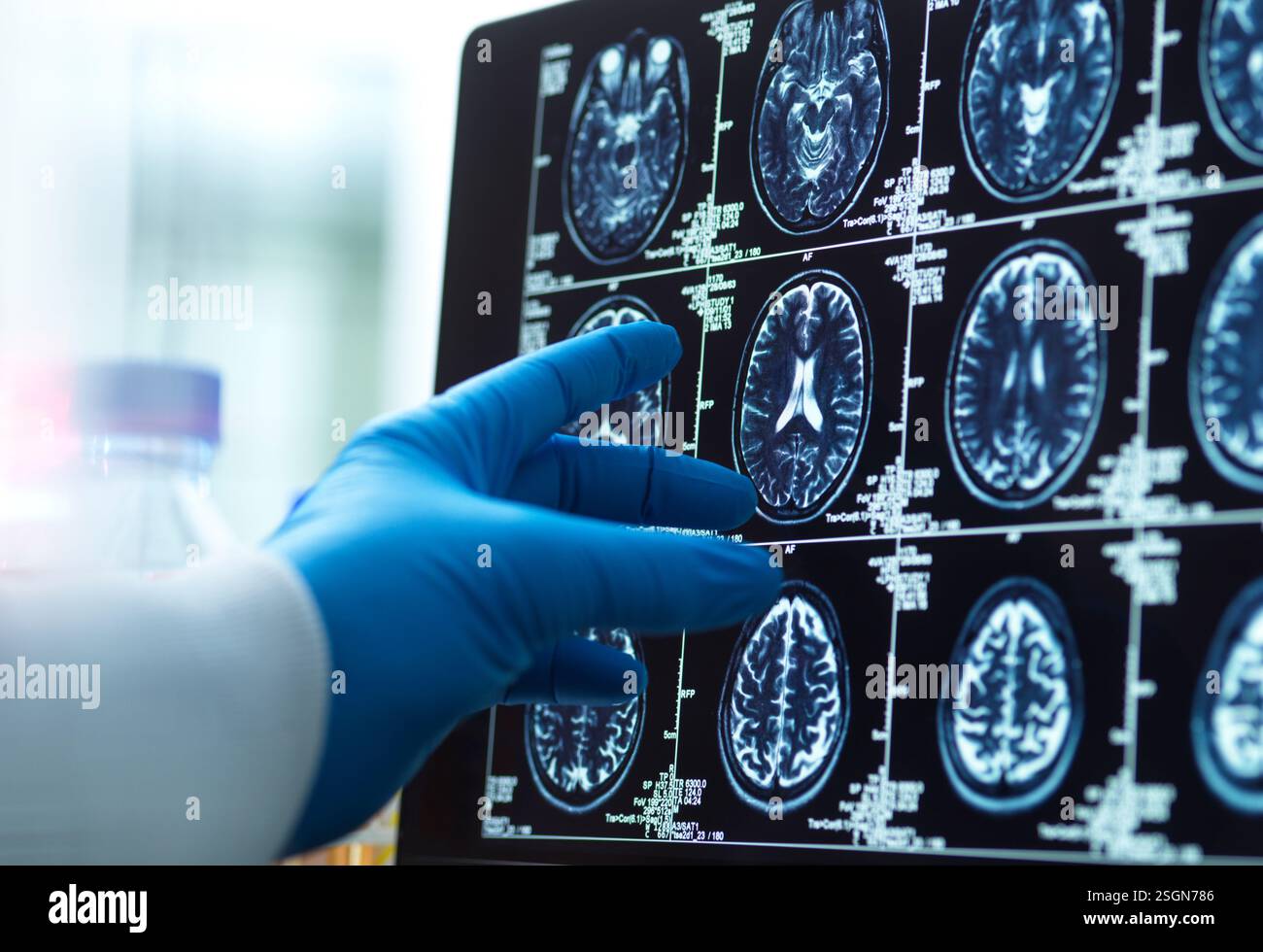 Médecin regardant un scan du cerveau pour un vieillissement et une maladie possibles Banque D'Images