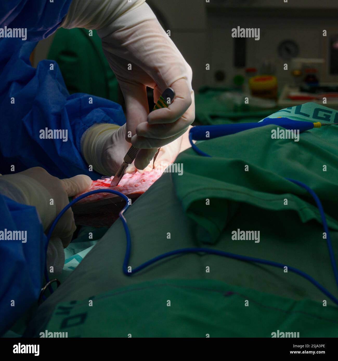 Le personnel chirurgical vétérinaire ampute l'aile d'un vautour griffon eurasien (Gyps fulvus) les chirurgiens vétérinaires dans un environnement stérile sont cutti Banque D'Images