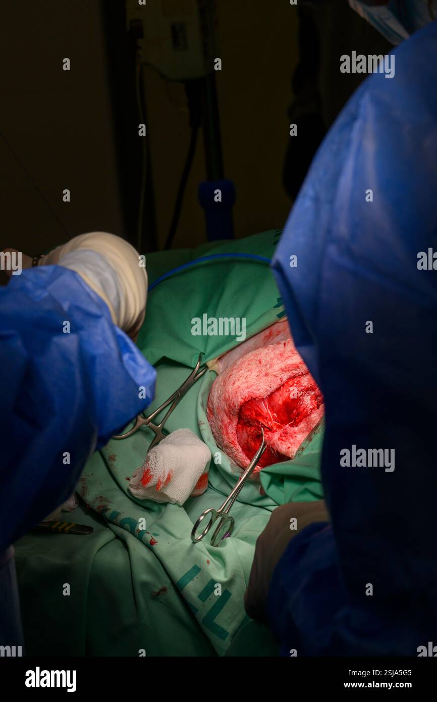 Le personnel chirurgical vétérinaire ampute l'aile d'un vautour griffon eurasien (Gyps fulvus) les chirurgiens vétérinaires dans un environnement stérile sont cutti Banque D'Images