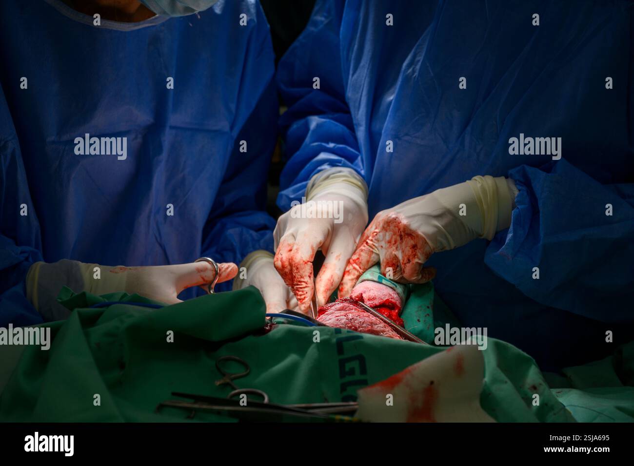 Le personnel chirurgical vétérinaire ampute l'aile d'un vautour griffon eurasien (Gyps fulvus) les chirurgiens vétérinaires dans un environnement stérile sont cutti Banque D'Images