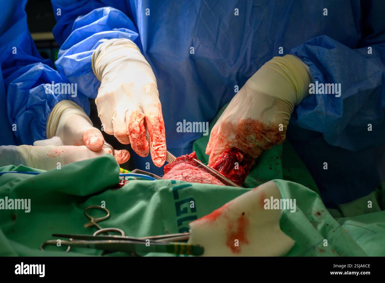 Le personnel chirurgical vétérinaire ampute l'aile d'un vautour griffon eurasien (Gyps fulvus) les chirurgiens vétérinaires dans un environnement stérile sont cutti Banque D'Images