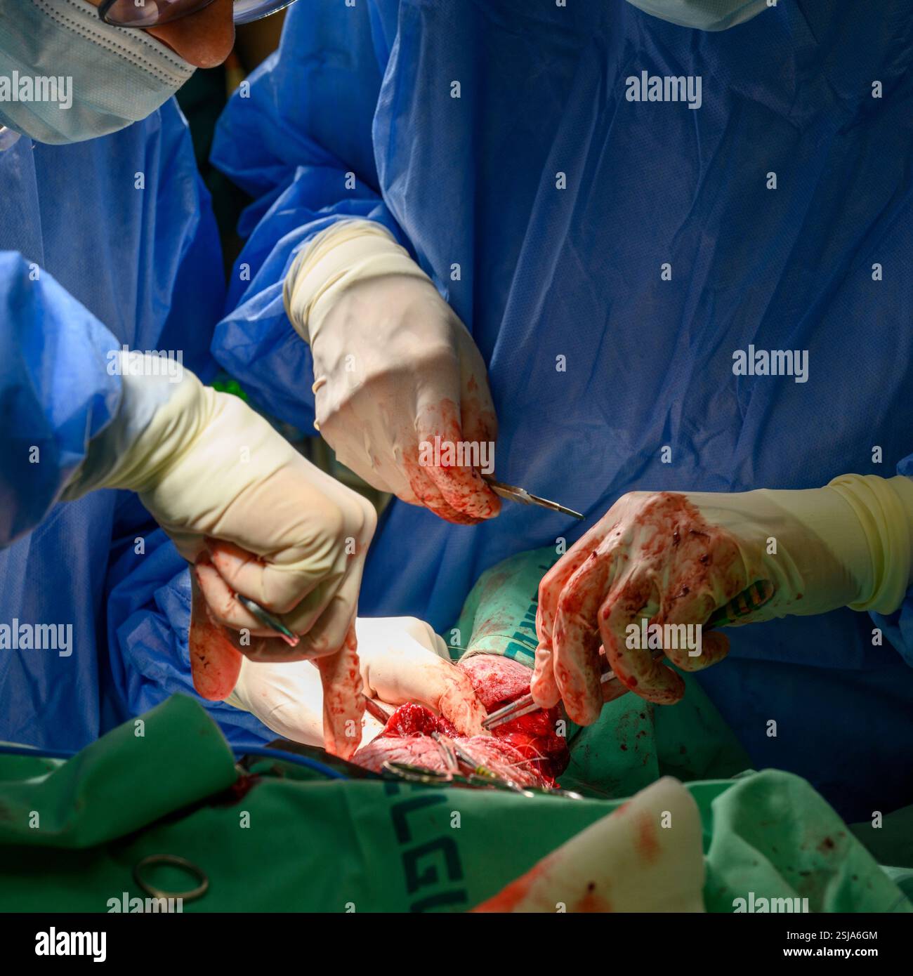 Le personnel chirurgical vétérinaire ampute l'aile d'un vautour griffon eurasien (Gyps fulvus) les chirurgiens vétérinaires dans un environnement stérile sont cutti Banque D'Images