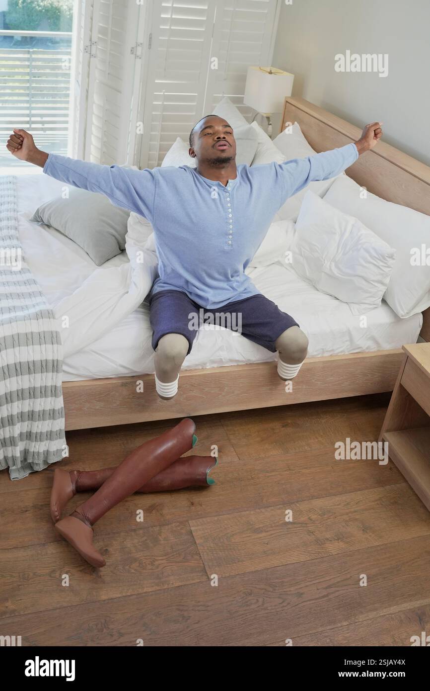 Homme aux jambes amputées assis sur le lit Banque D'Images