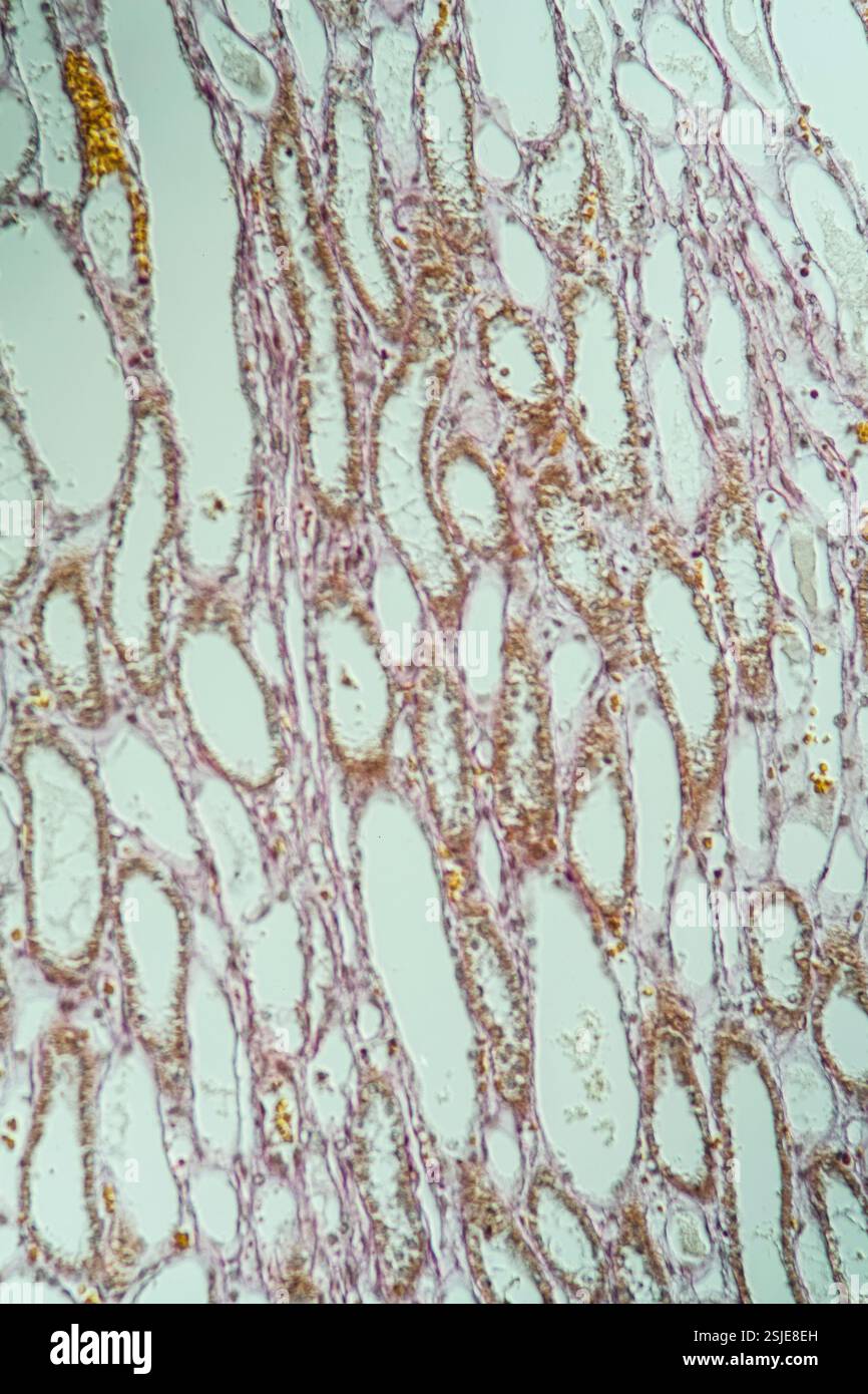 Tissu pulmonaire sain sous le microscope 200x Banque D'Images