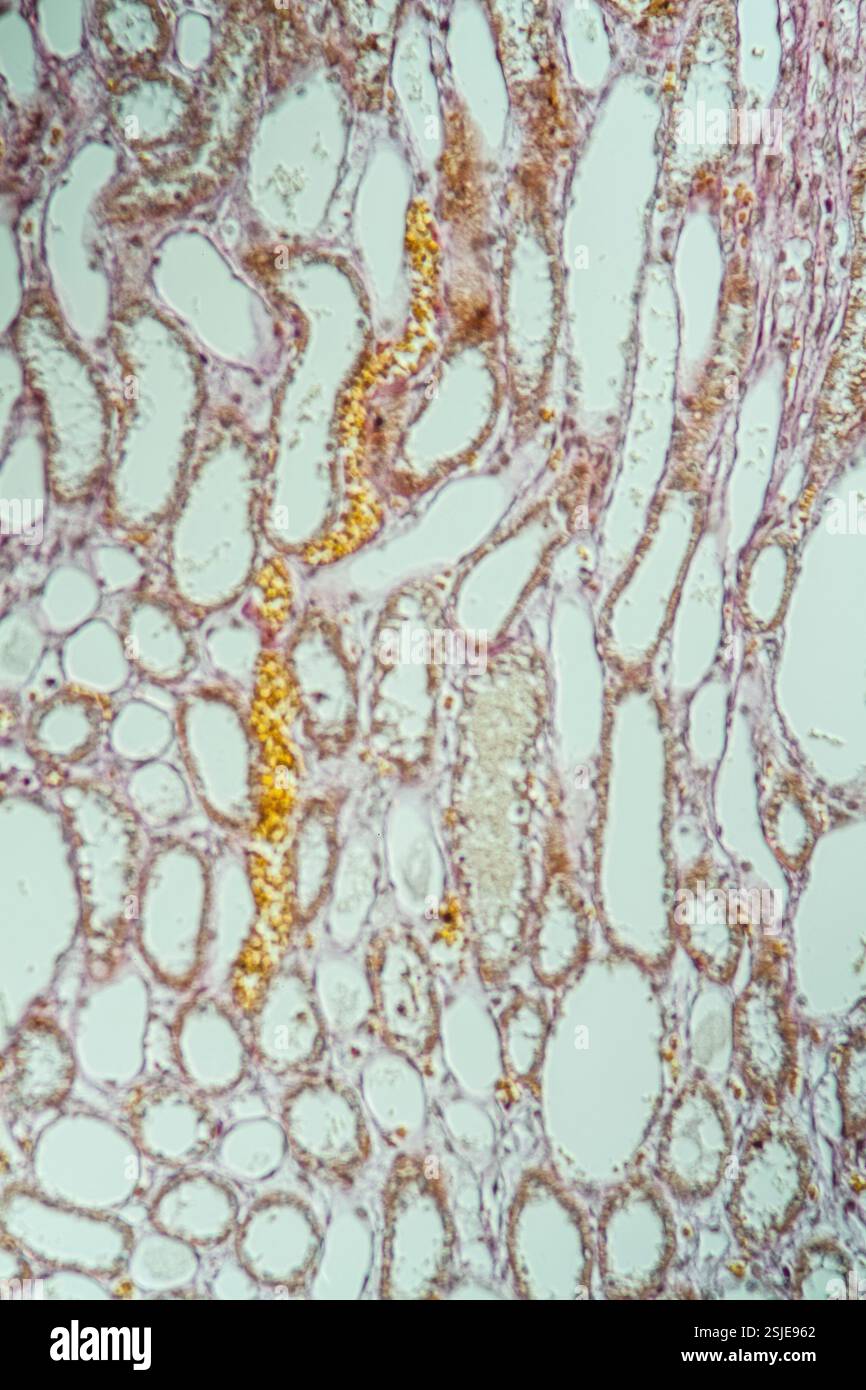 Tissu pulmonaire sain sous le microscope 200x Banque D'Images