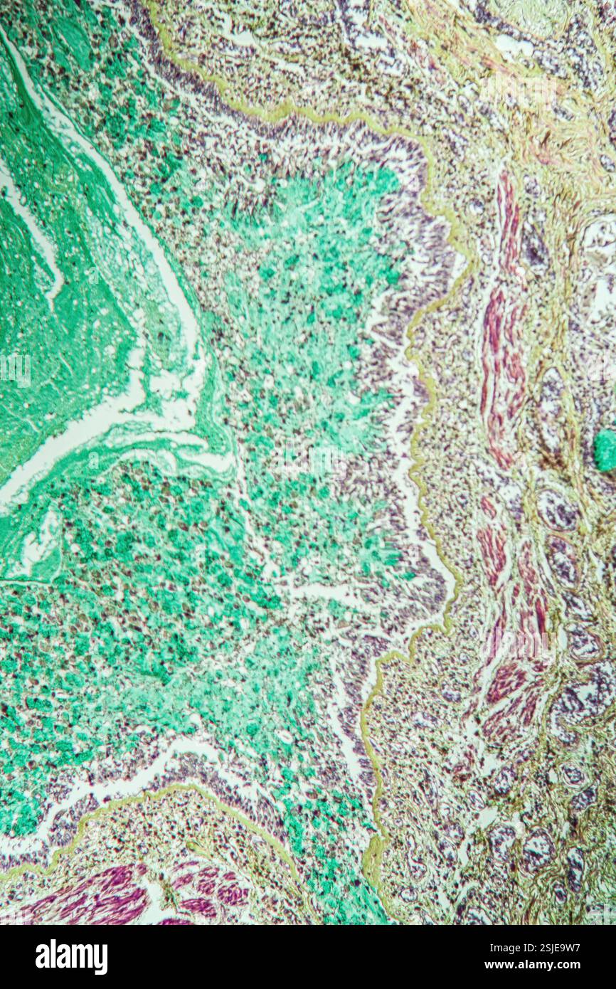 Tissu pulmonaire asthmatique au microscope Banque D'Images