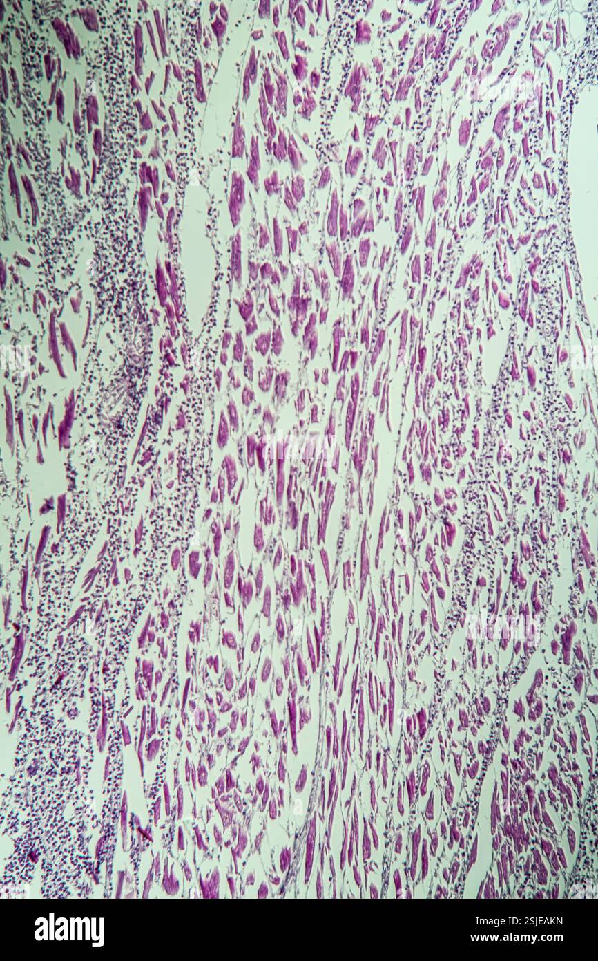 Muscle cardiaque enflammé sous le microscope 100x Banque D'Images