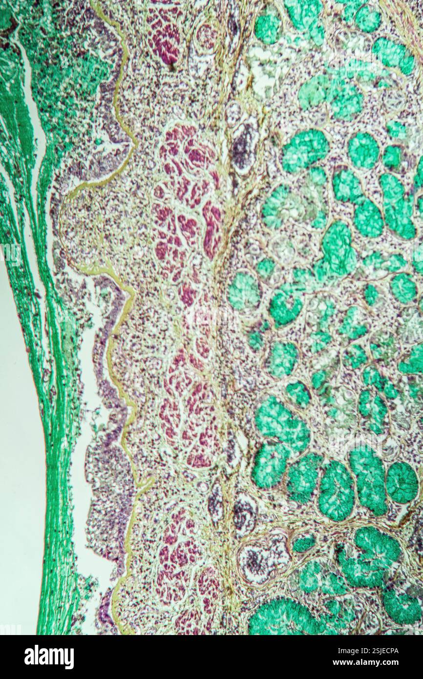 Poumons avec tissu asthmatique sous microscope Banque D'Images