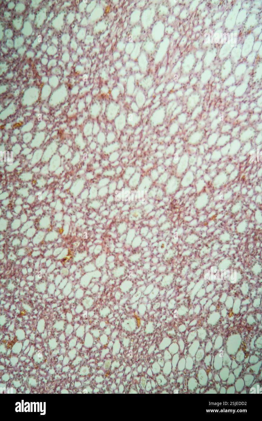 Tissu pulmonaire sain sous le microscope 100x Banque D'Images